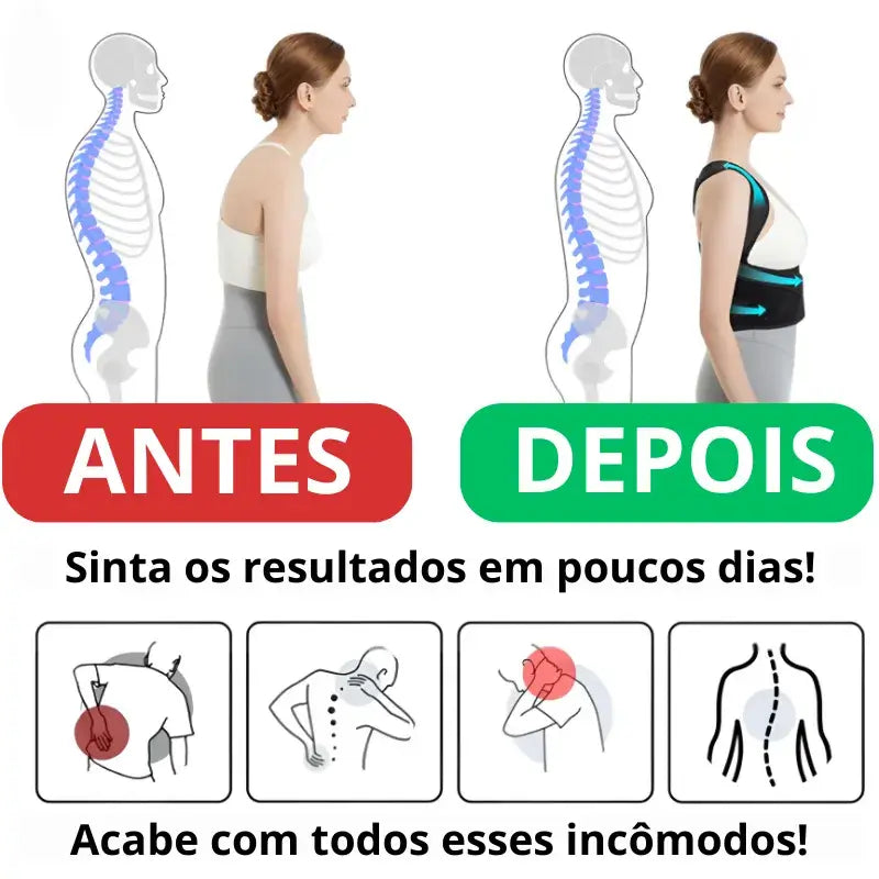 Corretor Postural Ajustável Unissex - Posture Pro© (COMPRE 1 LEVE 2)